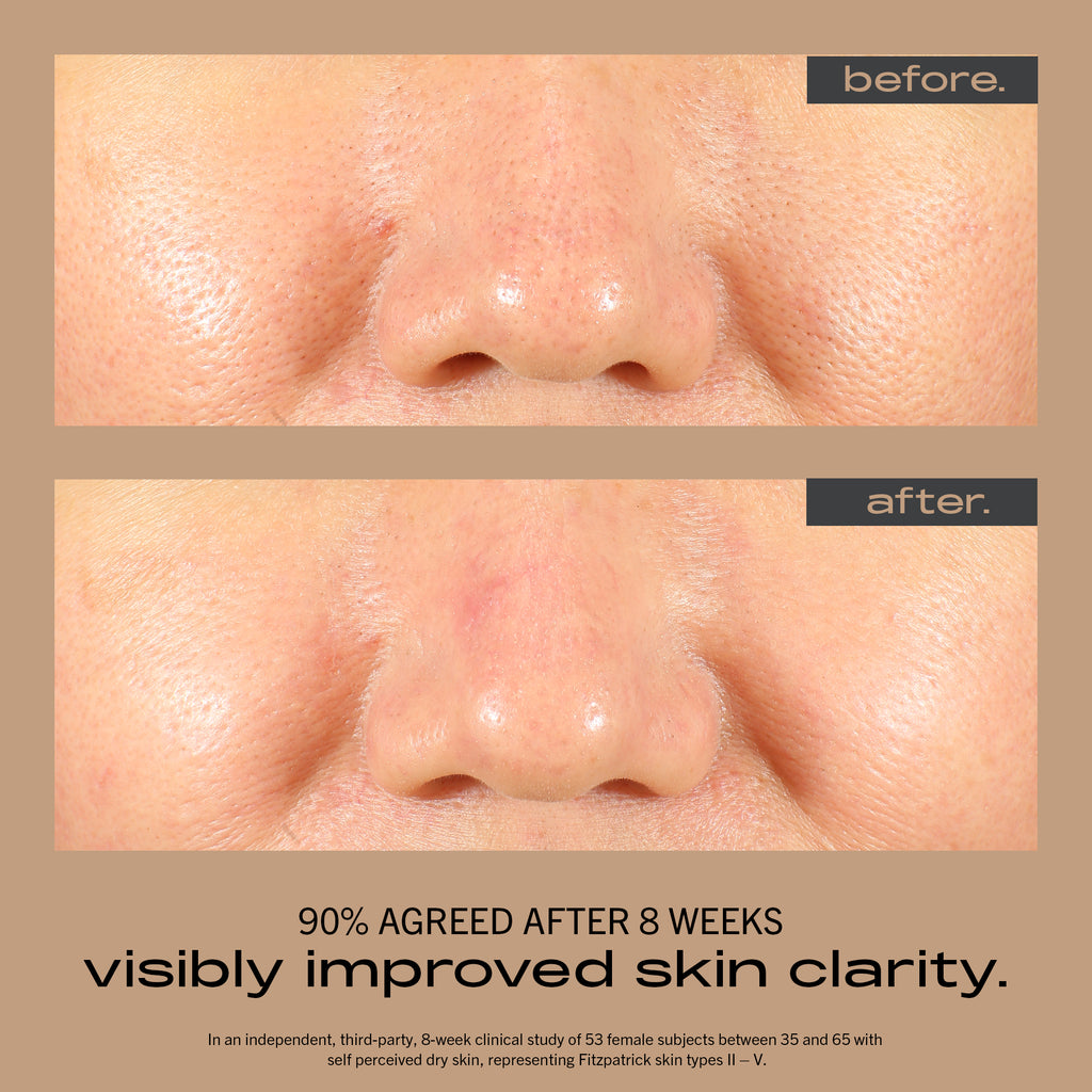 Resurfacing + Hydrating Serum - 30ml