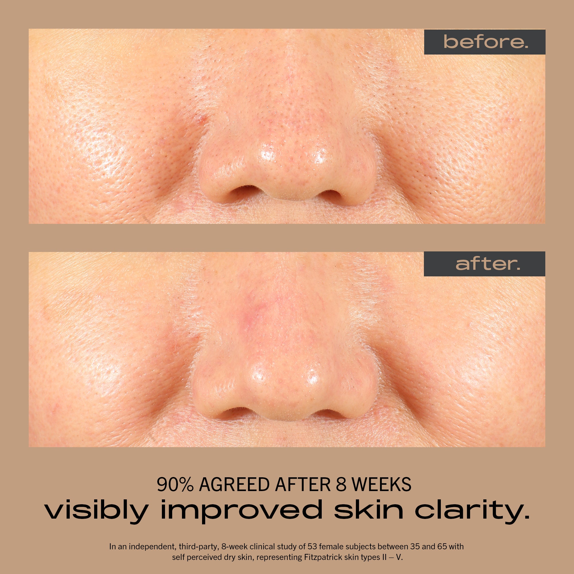 Resurfacing + Hydrating Serum - 30ml