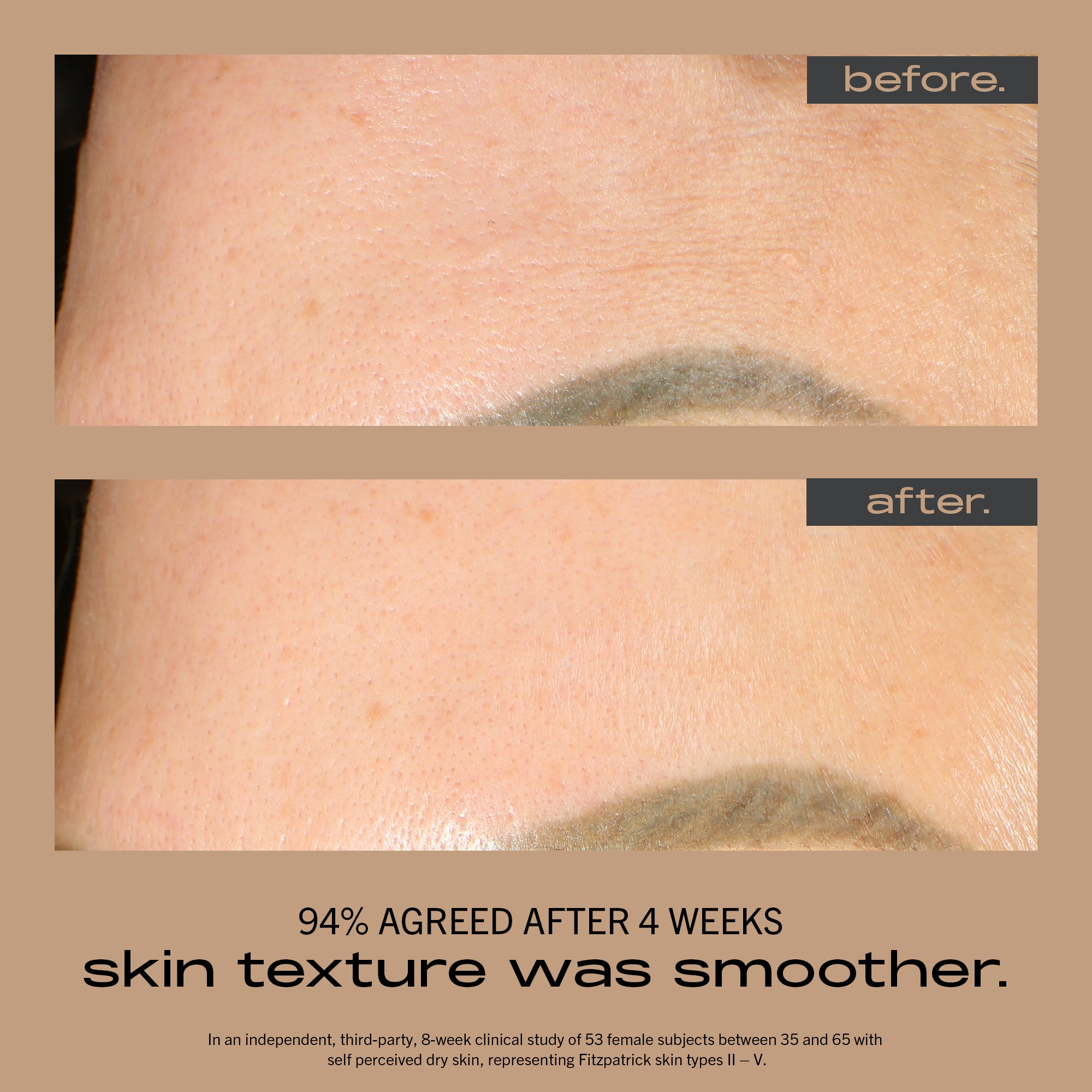 Resurfacing + Hydrating Serum - 30ml