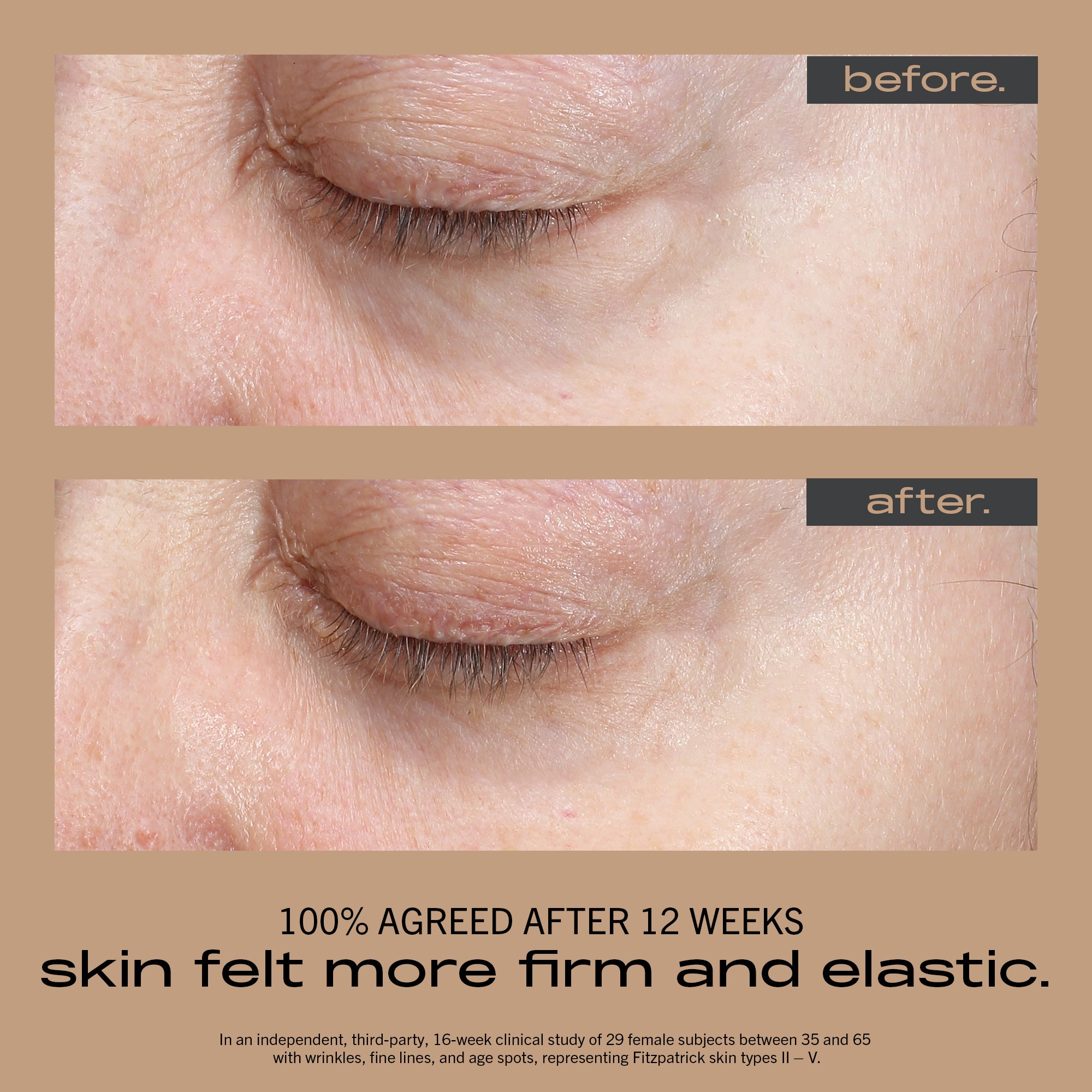 Wrinkle + Texture Concentrate - 30mL